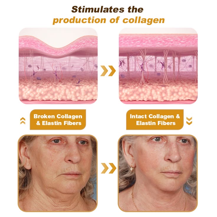 Botox Bee Venom Cream